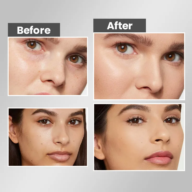 Hot Sale 49% OFFWhitening Hydrating Freckle Removing Face Cream