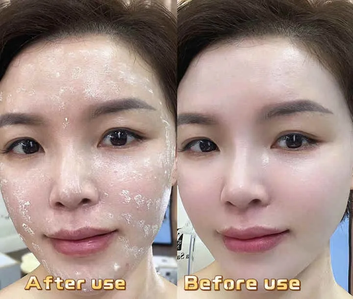 YIYIMEI Whitening Freckle Removal-كريم تبييض الوجه